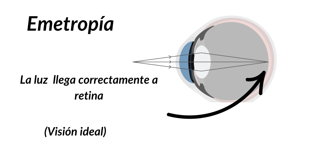 ojo-emetrope